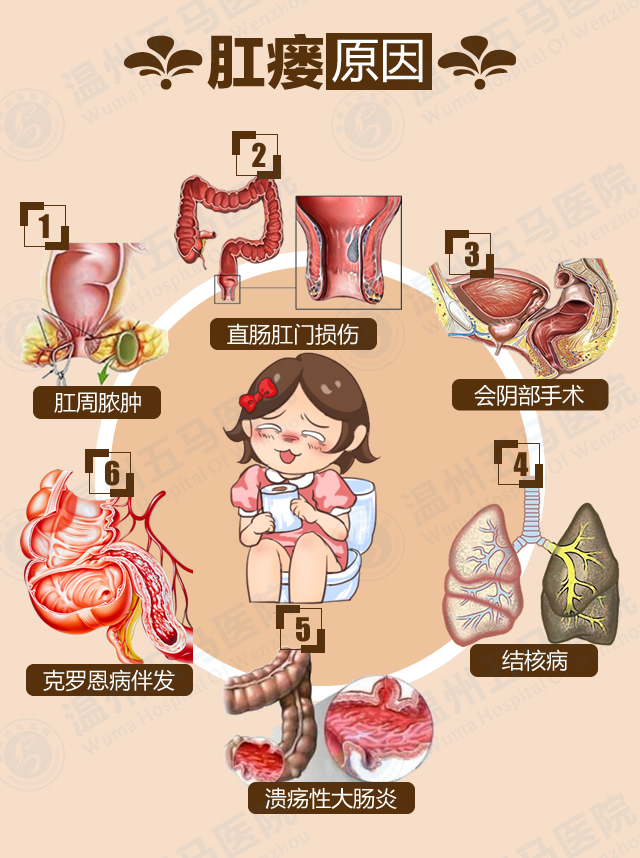 肛瘘-微信疾病科普