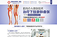 周围血管——扁平化医疗专题