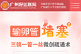 输卵管疏通专题
