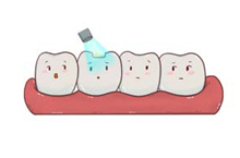 虫牙蛀牙龋齿补牙漫画一组、牙齿口腔医疗