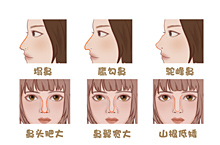 鼻型的不同种类  医疗插画/鼻型/鼻部/鼻子