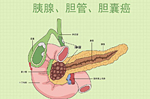 医疗消化系统肿瘤、癌症、健康