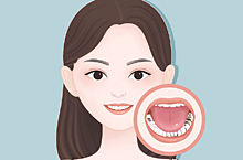 医美口腔牙齿疾病 牙齿矫正 牙齿类型 口腔