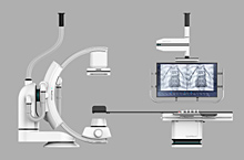 智加设计|唯迈医疗全新血管造影X射线机